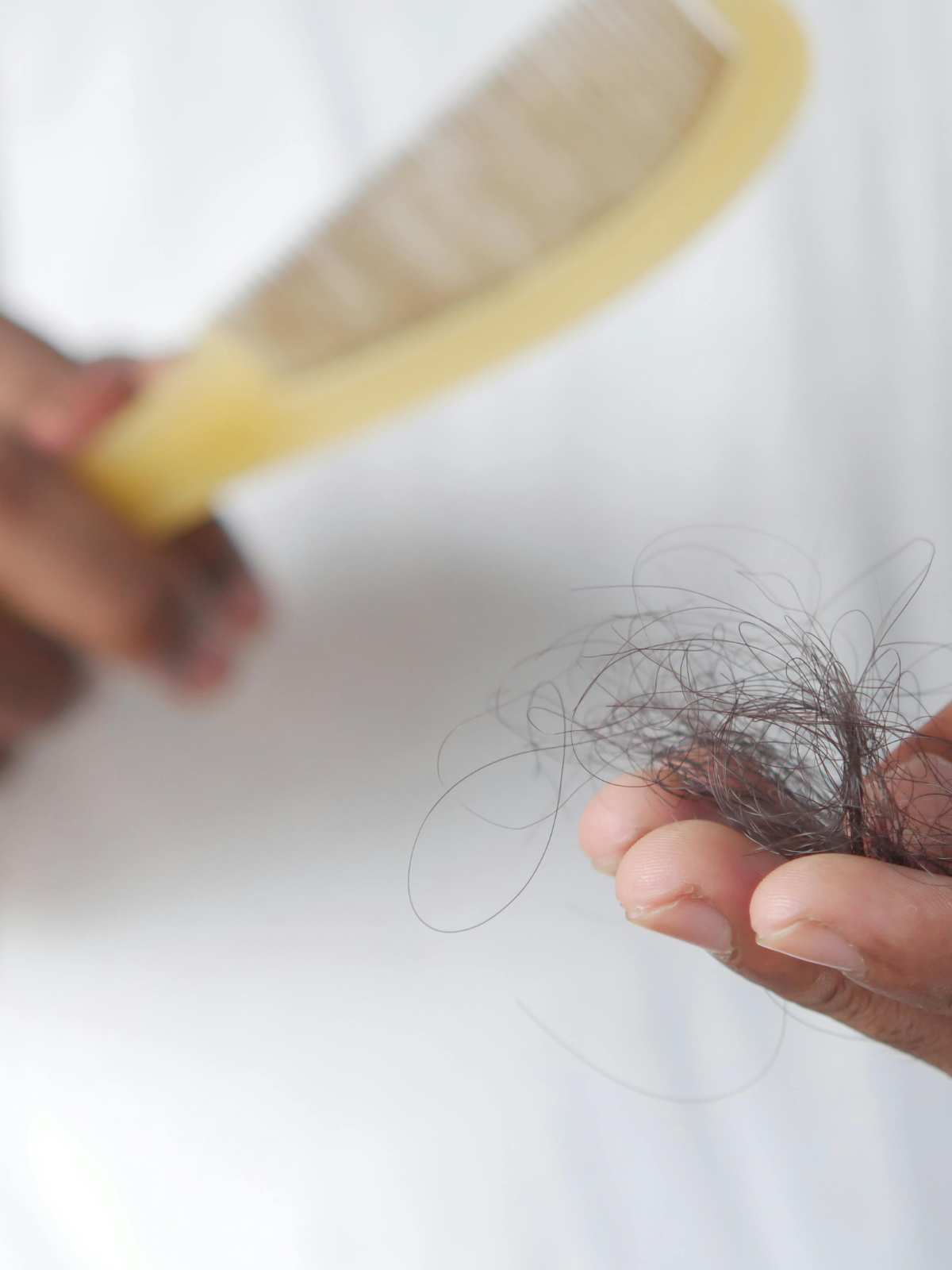 La chute de cheveux et l’hormone responsable : la DHT